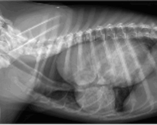 hernia